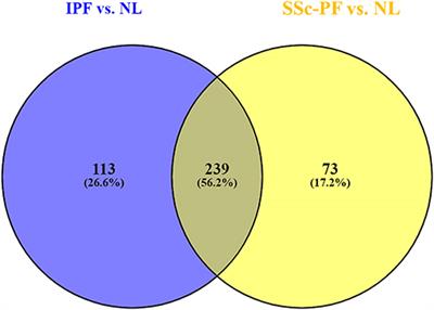 Prominence of IL6, IGF, TLR, and Bioenergetics Pathway Perturbation in Lung Tissues of Scleroderma Patients With Pulmonary Fibrosis